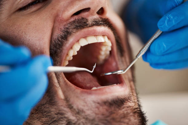 Best Cosmetic Emergency Dentistry in Marion, AL