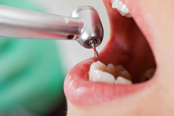 Best Emergency Gum Treatment in Marion, AL